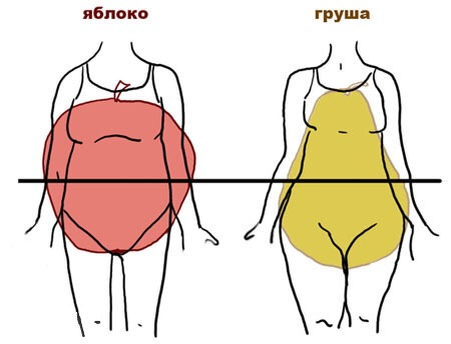 Ожирение по типу яблока прогностически хуже, чем по типу груши.
