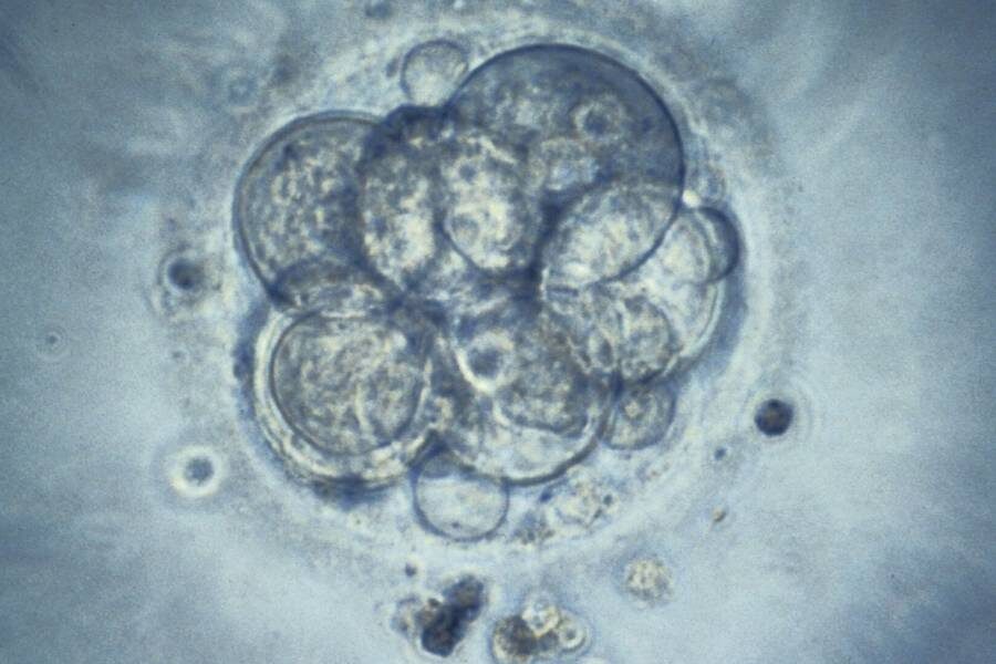 Человеческий эмбрион, предназначенный для экстракорпорального оплодотворения
Фото: K. Hardy / Wellcomeimages.com