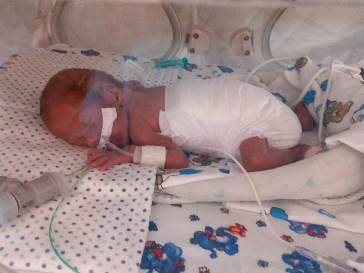 Фото из личного архива. 12 дней , реанимация. 