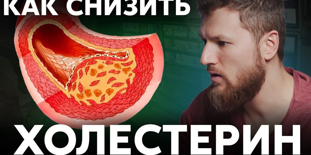 Холестерин 7 — Срочно Что-то Делать? Немедленно Действуйте, Это Не Шутки!