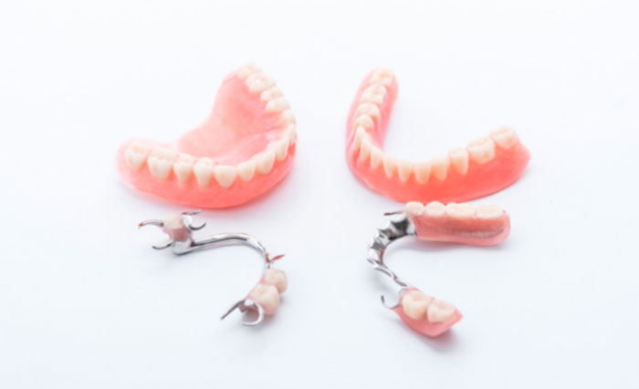 Виды зубных протезов: какие они бывают?