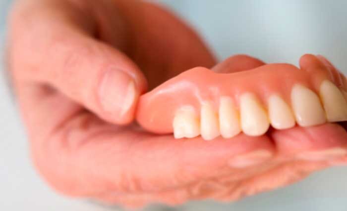 Какие виды зубных протезов существуют?