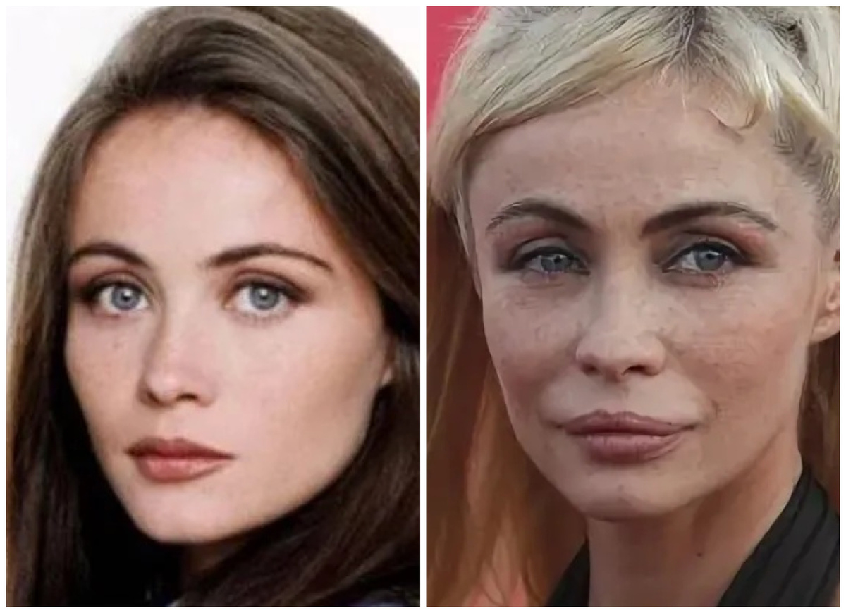 Эммануэль Беар