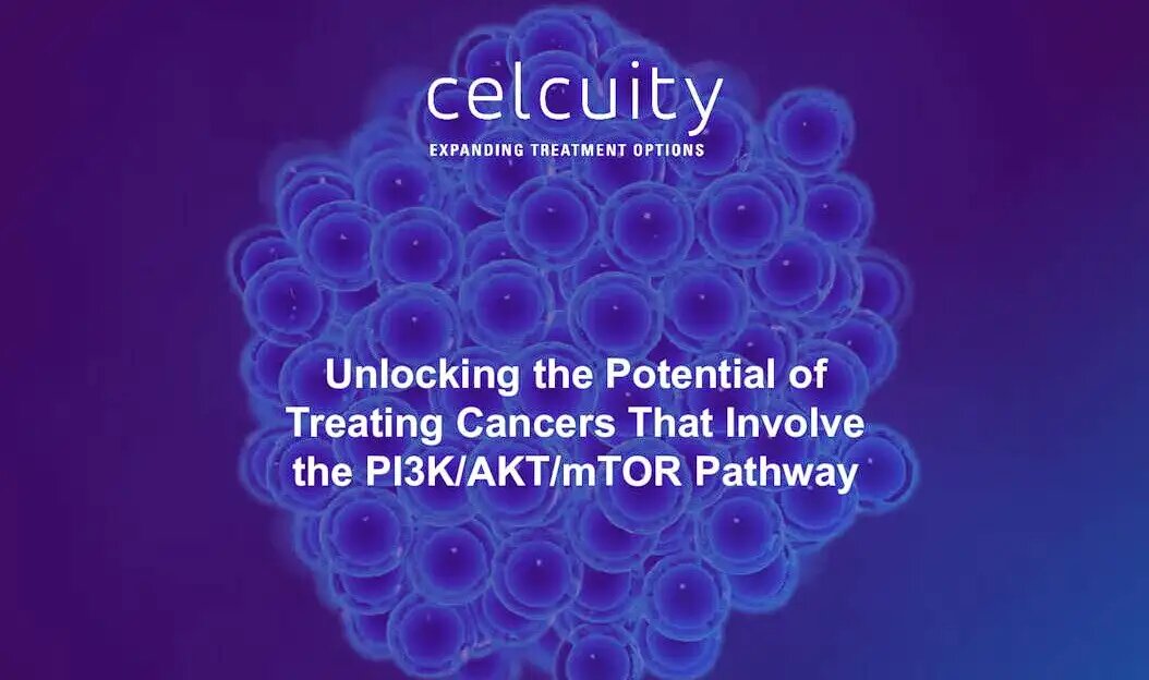 Акции Celcuity растут в преддверии ключевых результатов 