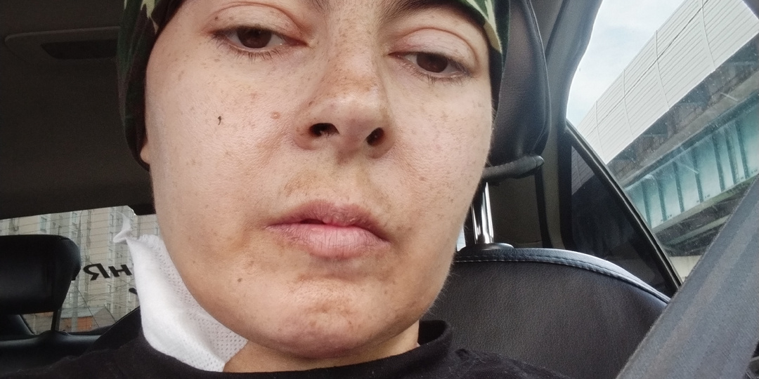 Выписка и пара дней дома.