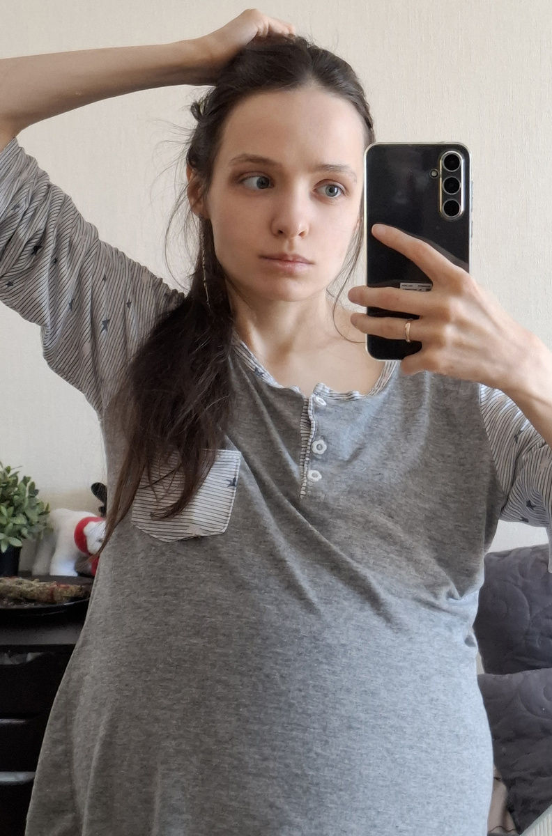 Асцит