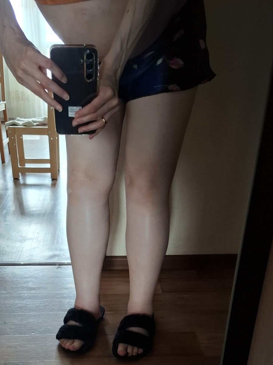 Отеки 20 апреля утром