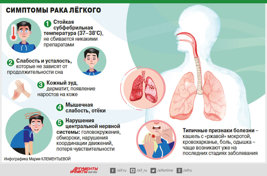    Инфографика, рак легких Фото: АиФ