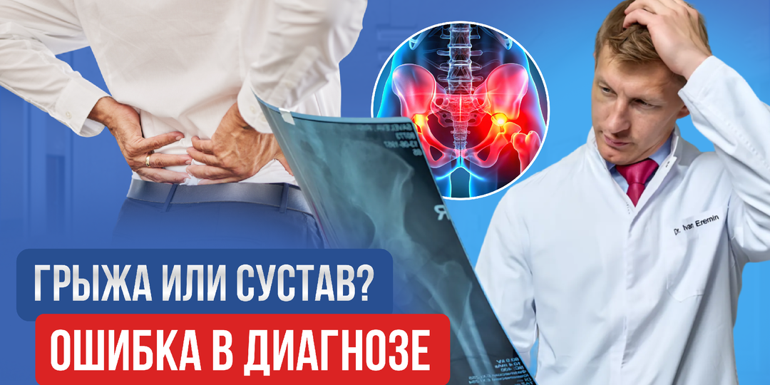 Ошибочный диагноз: почему тазобедренный сустав часто путают с грыжей