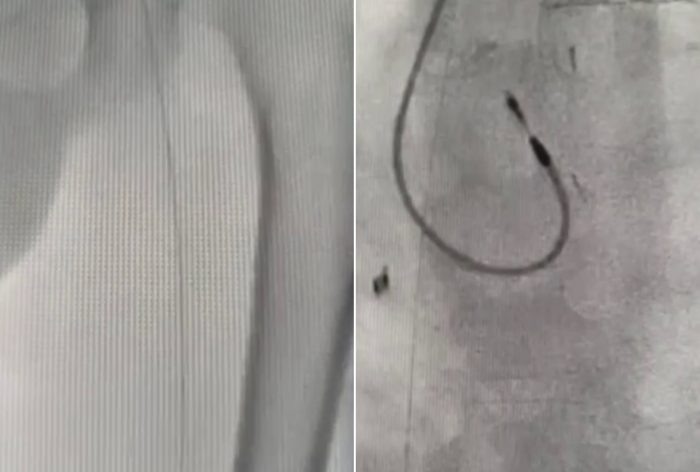 Кадр видео Mash Siberia.