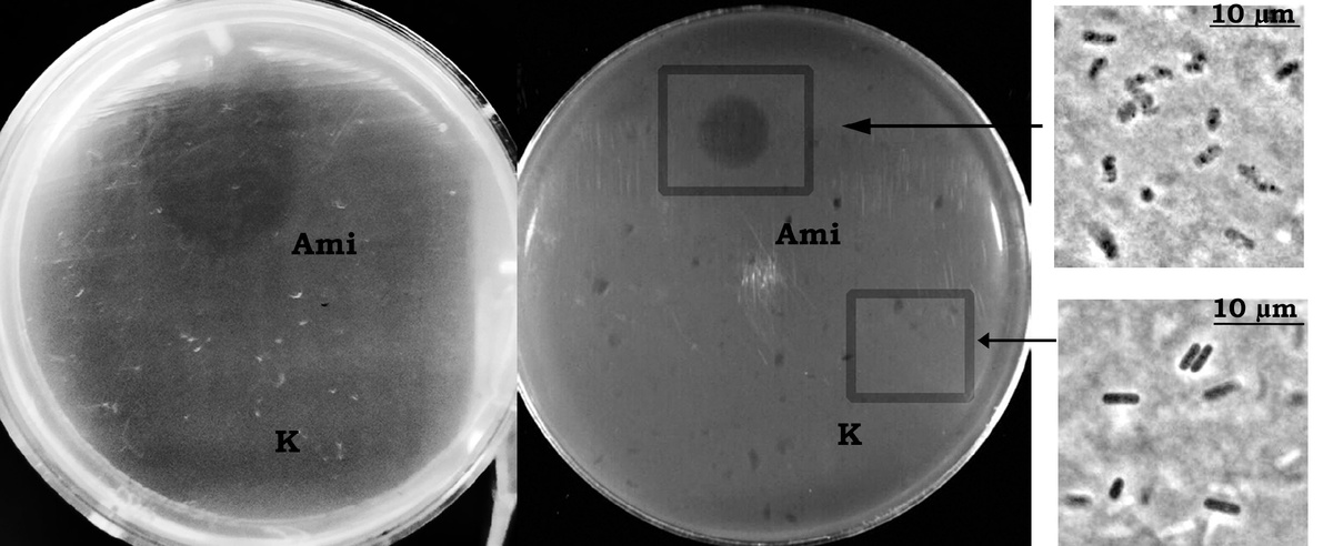 Чашки Петри с вплавленными в агар живыми клетками Bacillus, среди которых возбудитель сибирской язвы (крайняя левая панель). В месте нанесения фермента Ami видна зона просветления, что указывает на гибель бактериальных клеток. Справа результаты фазово-контрастной микроскопии: клетки после обработки ферментом (сверху) и не обработанные ферментом бациллы (снизу). Источник: Ирина Кудрякова