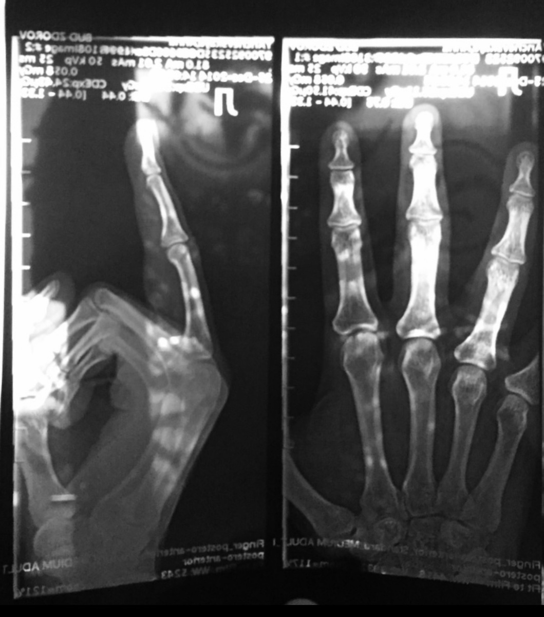 Сильно спешила на работу в тот день :)