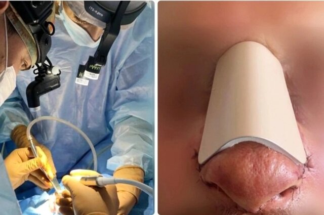    Хирургическое вмешательство. Фото: Департамент здравоохранения Югры