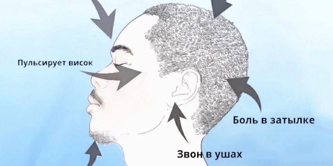 Головная боль: как определить причину по локализации и что делать