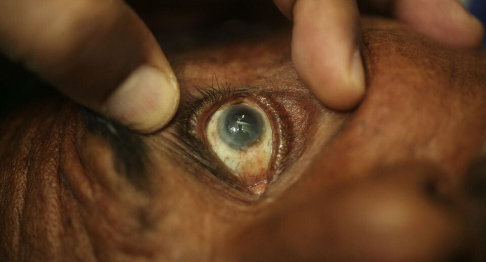    001 Stewart Goldstein/Medicimage/Global Look Press / www.globallookpress.com