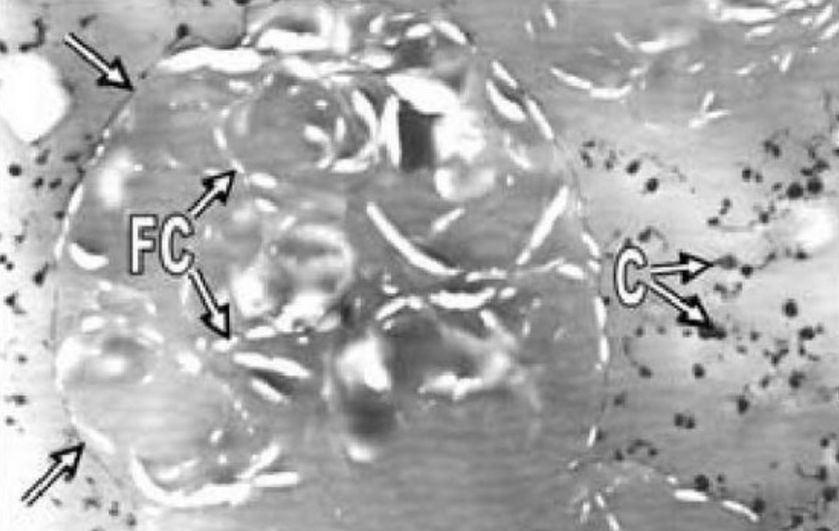 Вот замороженный образец сливок, чтобы дать вам представление. Стрелки обозначают белок, FC — кристаллы жира, а C — мицеллы казеина. Масштаб — 1,5 микрона