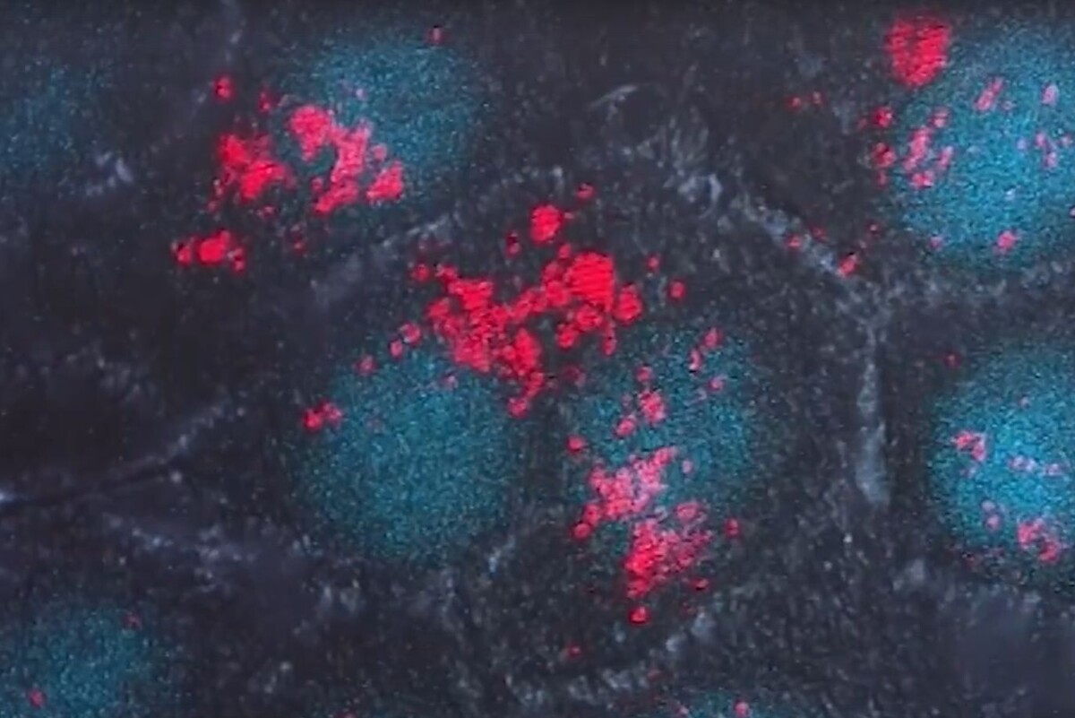 Красные «метки» на клетках рака шейки матки – результат работы аптамеров