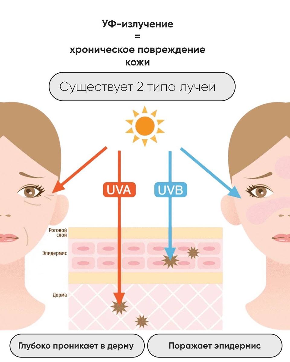 Типы УФ лучей 