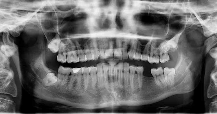 Изображение: Pixabay