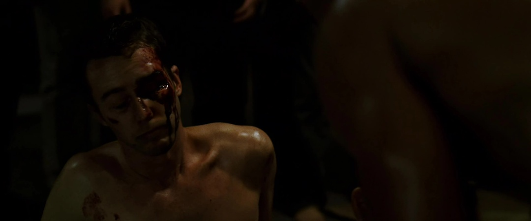 Джек с разбитым лицом.