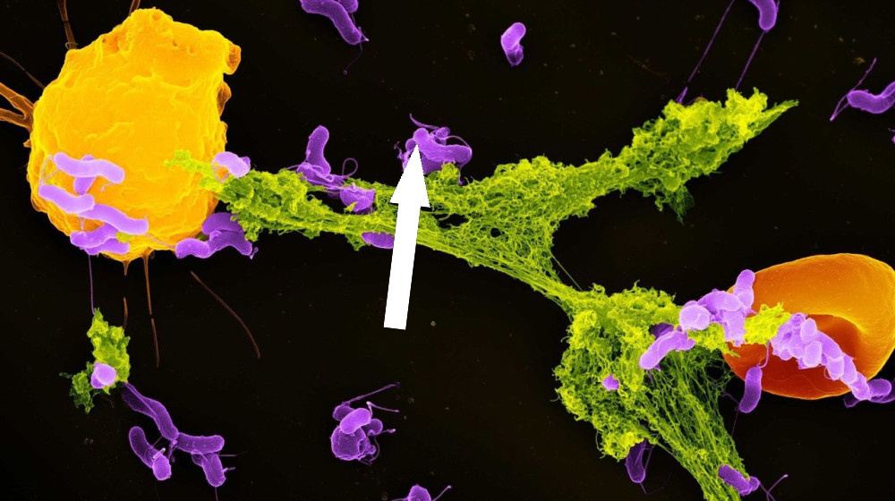    Митохондрии не только выделяют энергию — они борются с микробами