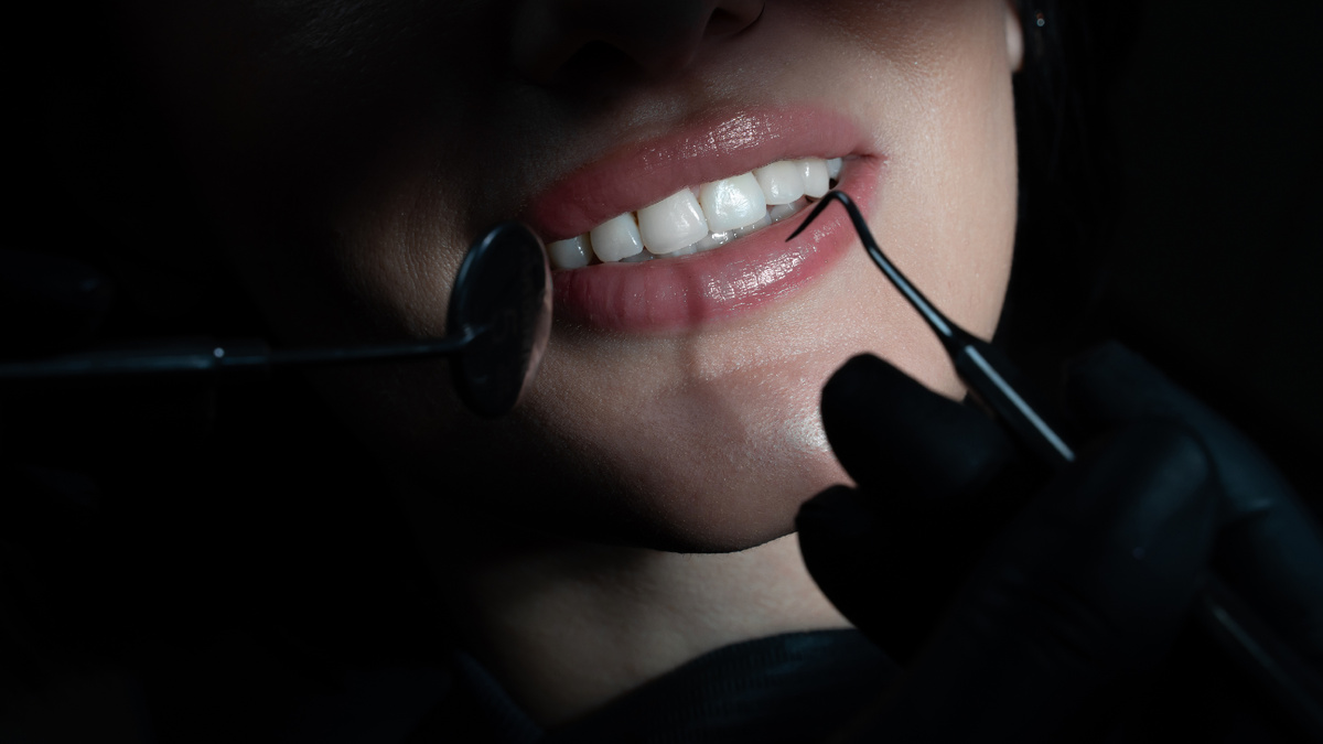 Могут ли зубы разъехаться с ретейнером