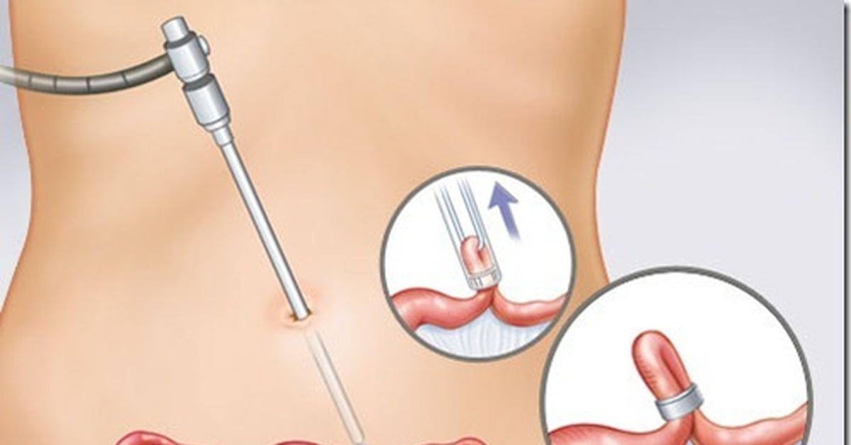 Для иллюстрации... 