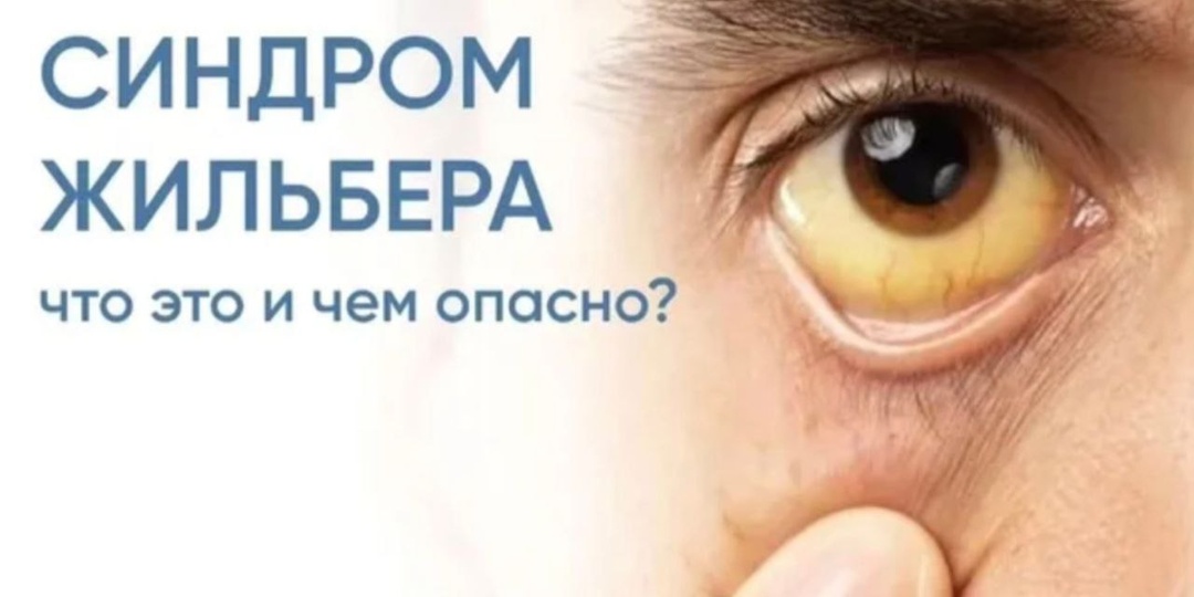 Чем опасен синдром Жильбера и что делать