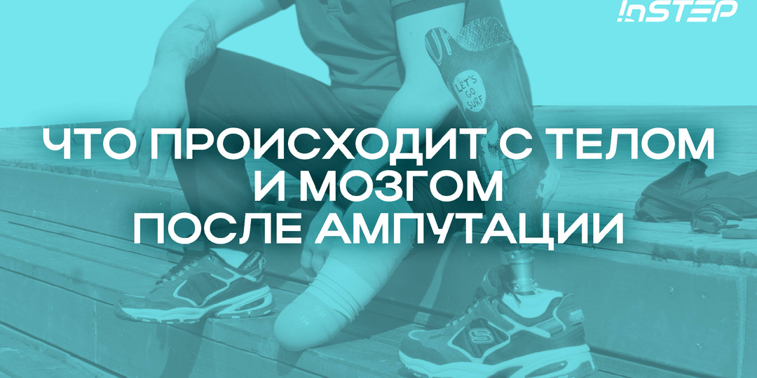 Что происходит с телом и мозгом после ампутации: фантомные боли, перестройка восприятия и путь к восстановлению