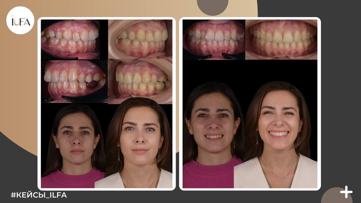 Листайте карусель вправо