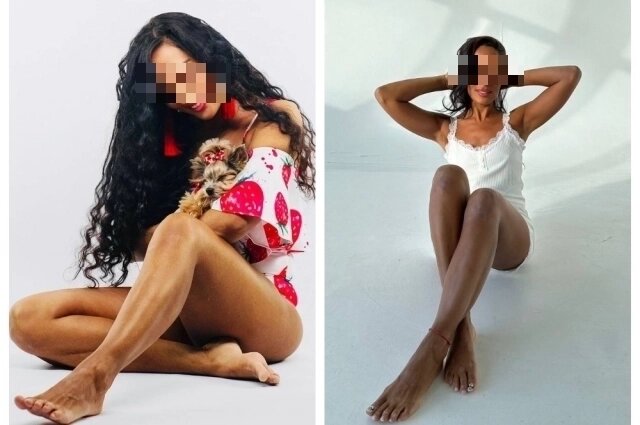    Состояние ног Кристины до процедуры. Фото: Предоставлено героем публикации "АиФ-Новосибирск"