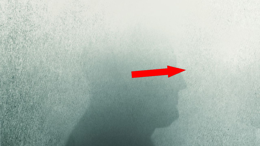    Тайны деменции раскрыты: что вам нужно знать об Альцгеймере и других формах