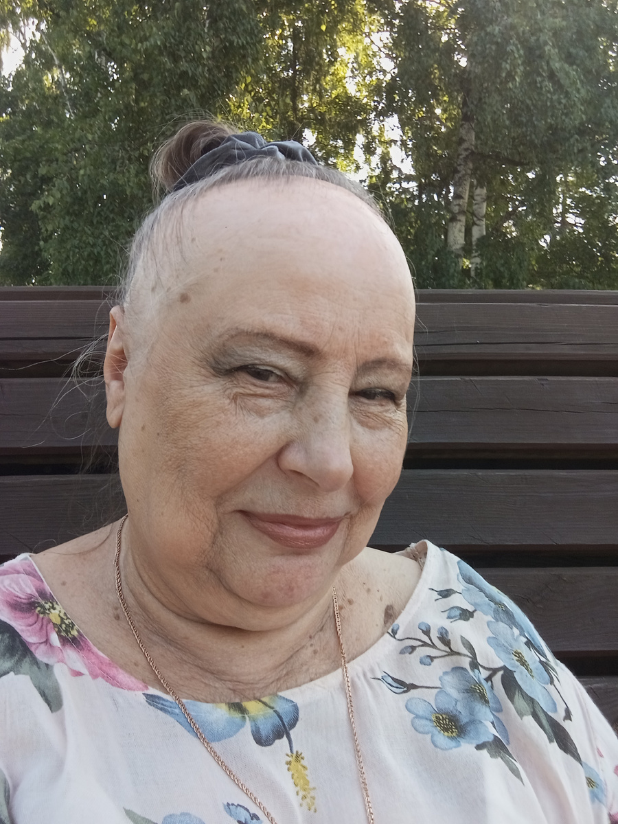 Привет, Всем! Так сейчас выгляжу. В 72 жизнь продолжается.