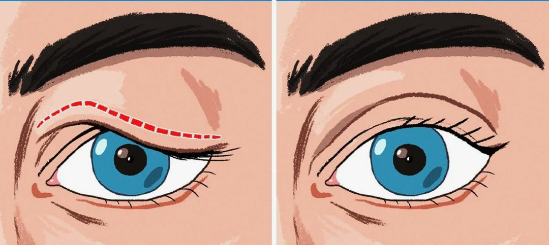 Раньше я их не оценила, а сейчас использую и подтягиваю веки, открываю глаза быстро и без крема для глаз за 5 минут