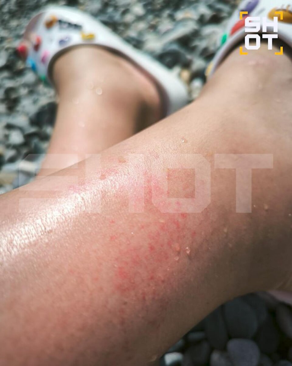     Фото: ТГ-канал SHOT