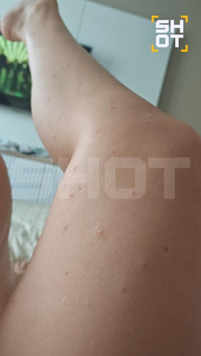     Фото: ТГ-канал SHOT