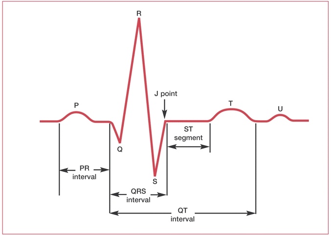 Волны P, QRS, T и интервалы между ними на электрокардиограмме. Источник изображения: https://www.ncbi.nlm.nih.gov/books/NBK2214/.