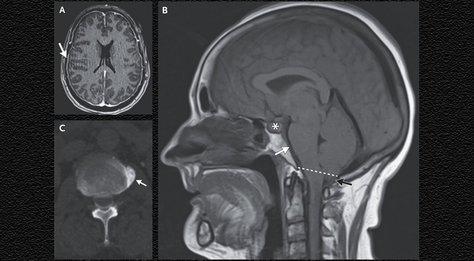   Syeda Busmah Owais, Yasaman Kianirad / NEJM, 2025