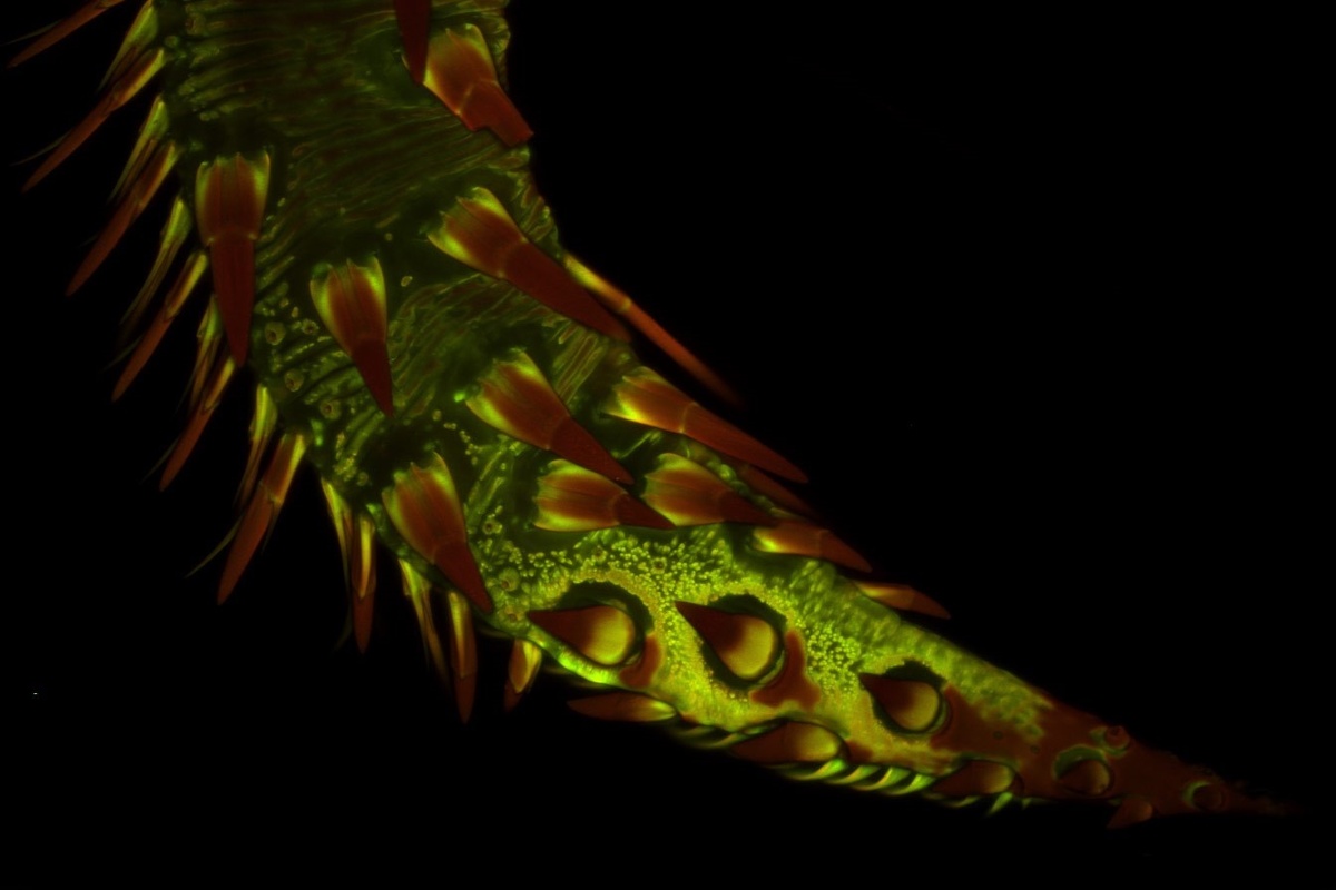 Хоботок Калиптры василистниковой (Calyptra thalictri) под микроскопом. Фото Dr. Matthew S. Lehnert, 2015 г. 