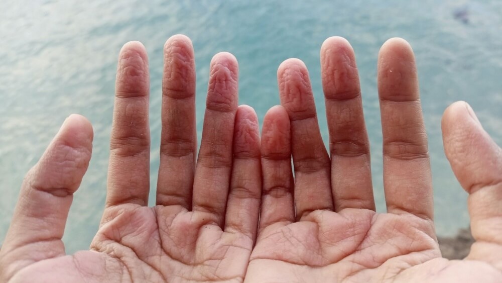    Морщины на пальцах после купания — не просто странный побочный эффект, а древний эволюционный механизм. Источник изображения: naukatv.ru