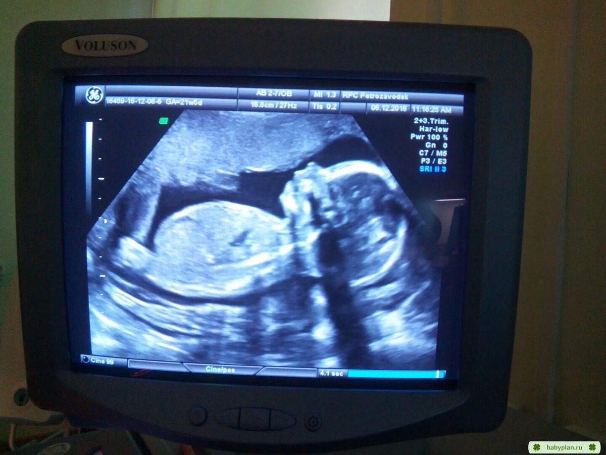 Из Яндекс картинок для иллюстрации 