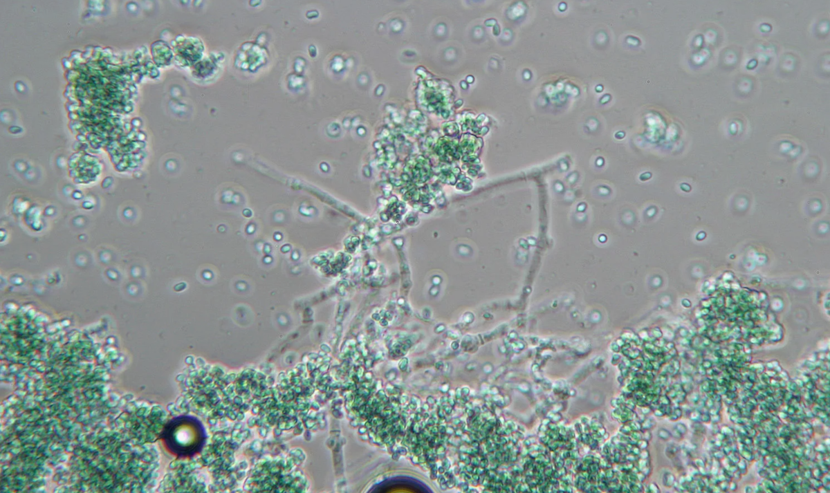 триходерма под микроскопом