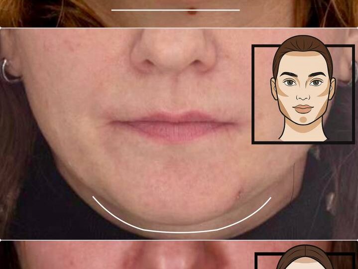 «У меня лицо стало квадратным». Что это значит на самом деле?