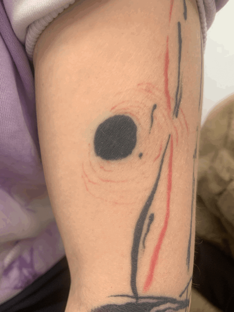 Фото: центр удаления татуировок «Дисциплина»