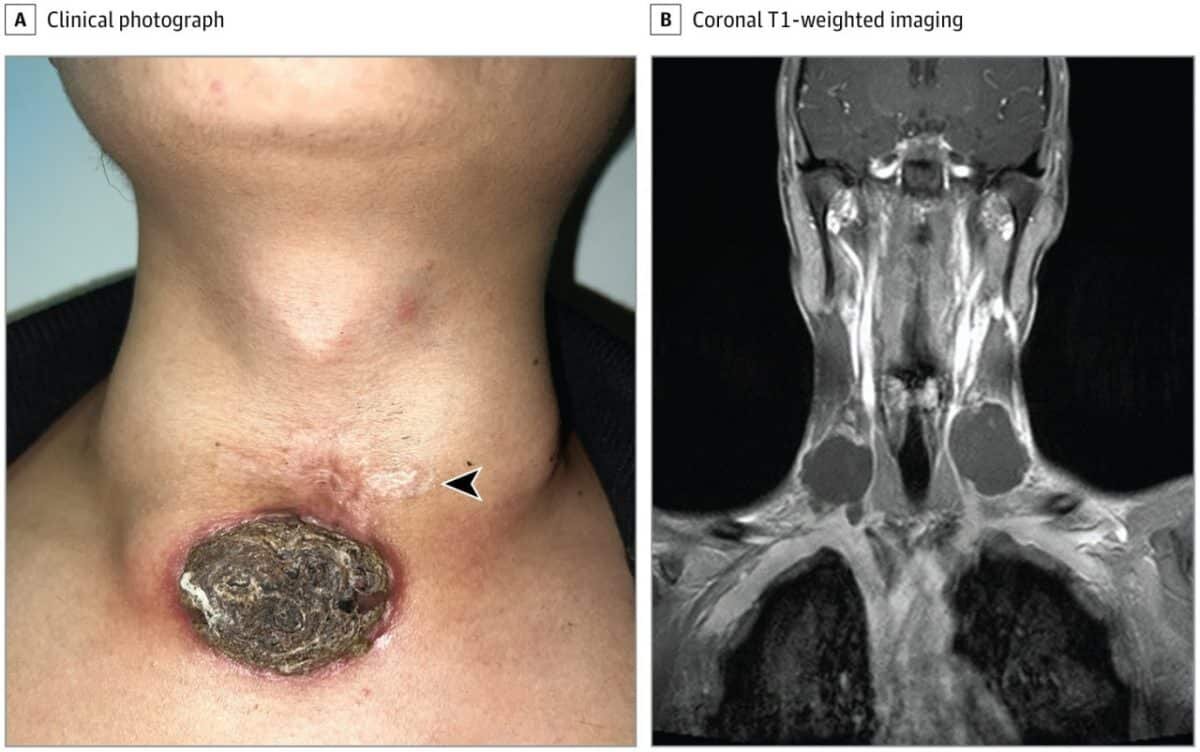    © Yang L, Li W., JAMA Otolaryngology–Head & Neck Surgery (2025)
