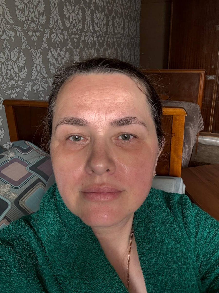 Автор с патчами и без фильтров, ждёт гостей. Лоб блестит, потому что автор - золото. 