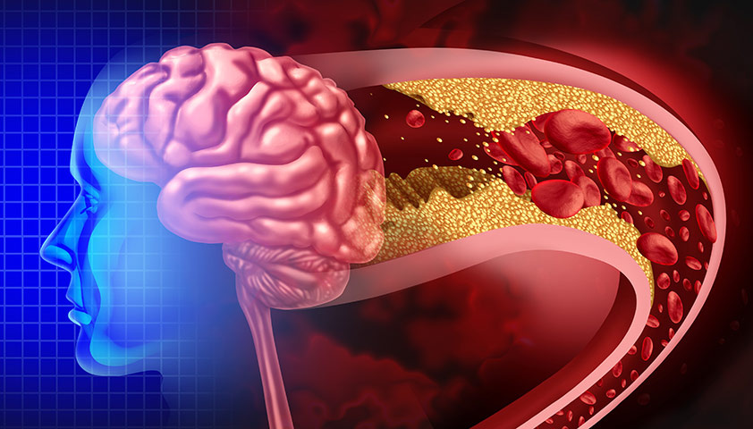 Как статины и растительная диета на самом деле влияют на ваше психическое здоровье