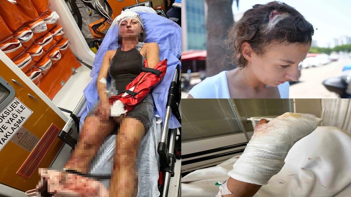 Девушка получила тяжёлые травмы. 