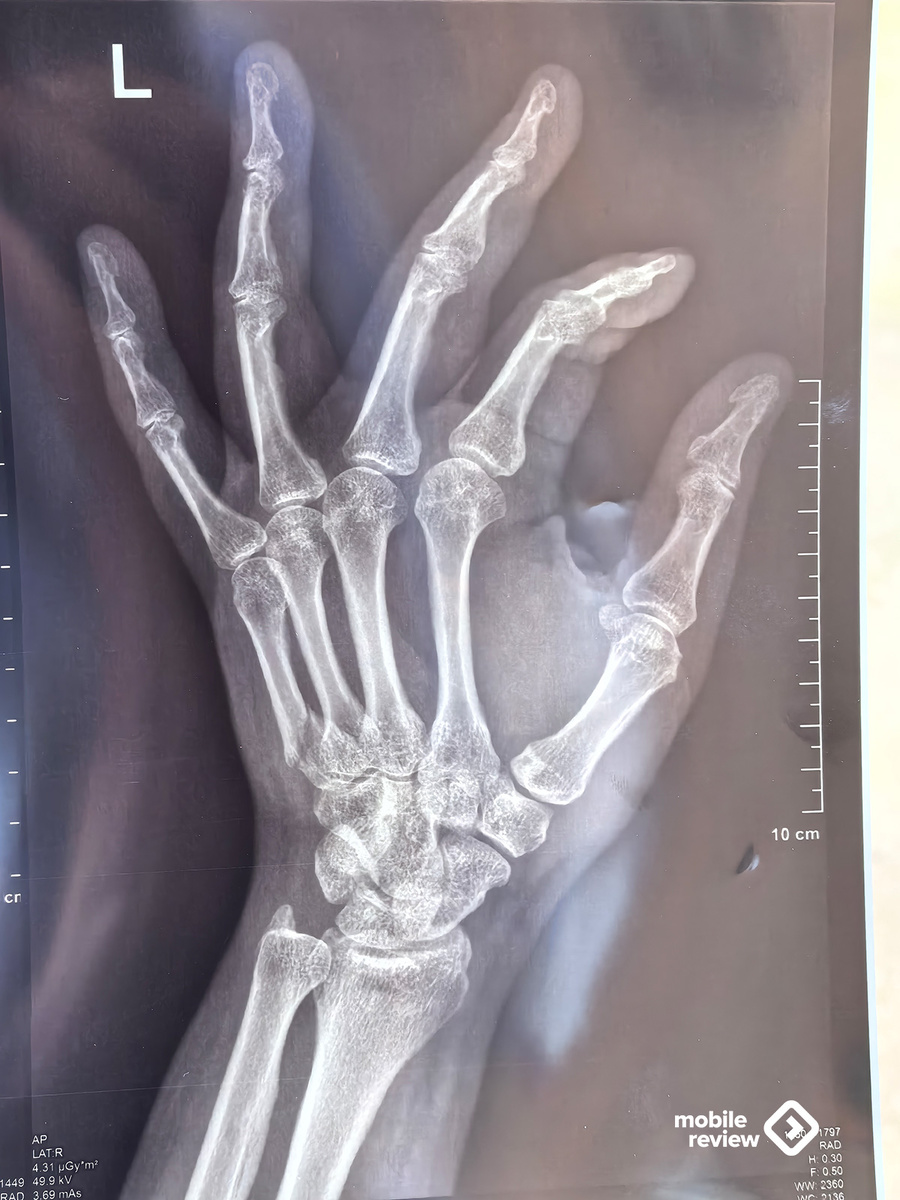 Листайте вправо, чтобы увидеть больше изображений