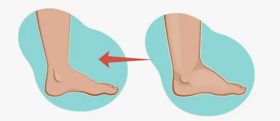 Никаких отеков в ногах, напряженной спины и просто польза для малого таза: скручиваем колени внутрь